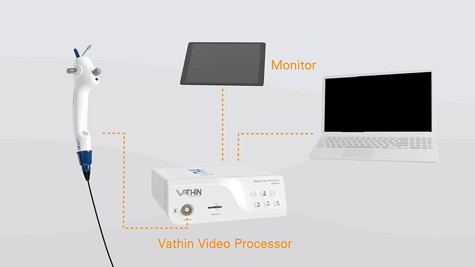 醫(yī)療器械 無菌支氣管鏡三維動(dòng)畫