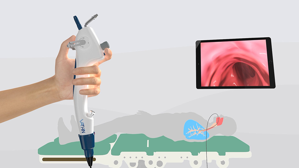 醫(yī)療器械 無菌支氣管鏡三維動(dòng)畫